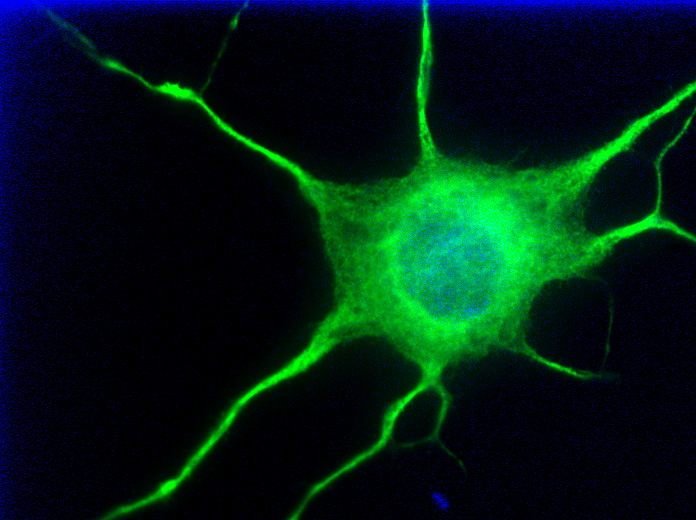 Image of human induced pluripotent stem cells